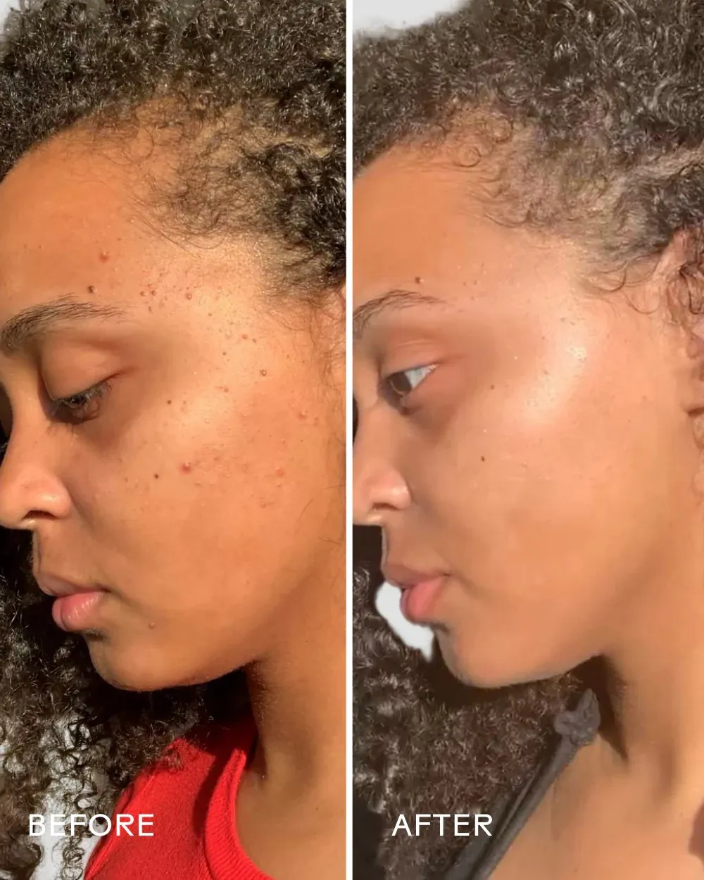 Superfruit Lactic   Multifruit 8% AHA Exfoliating Mask